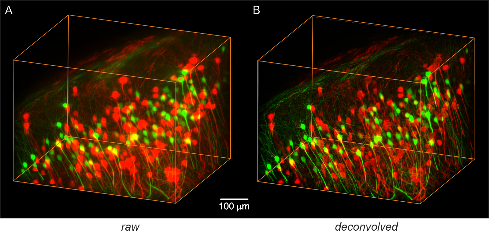 Double stained mouse hippocampus.