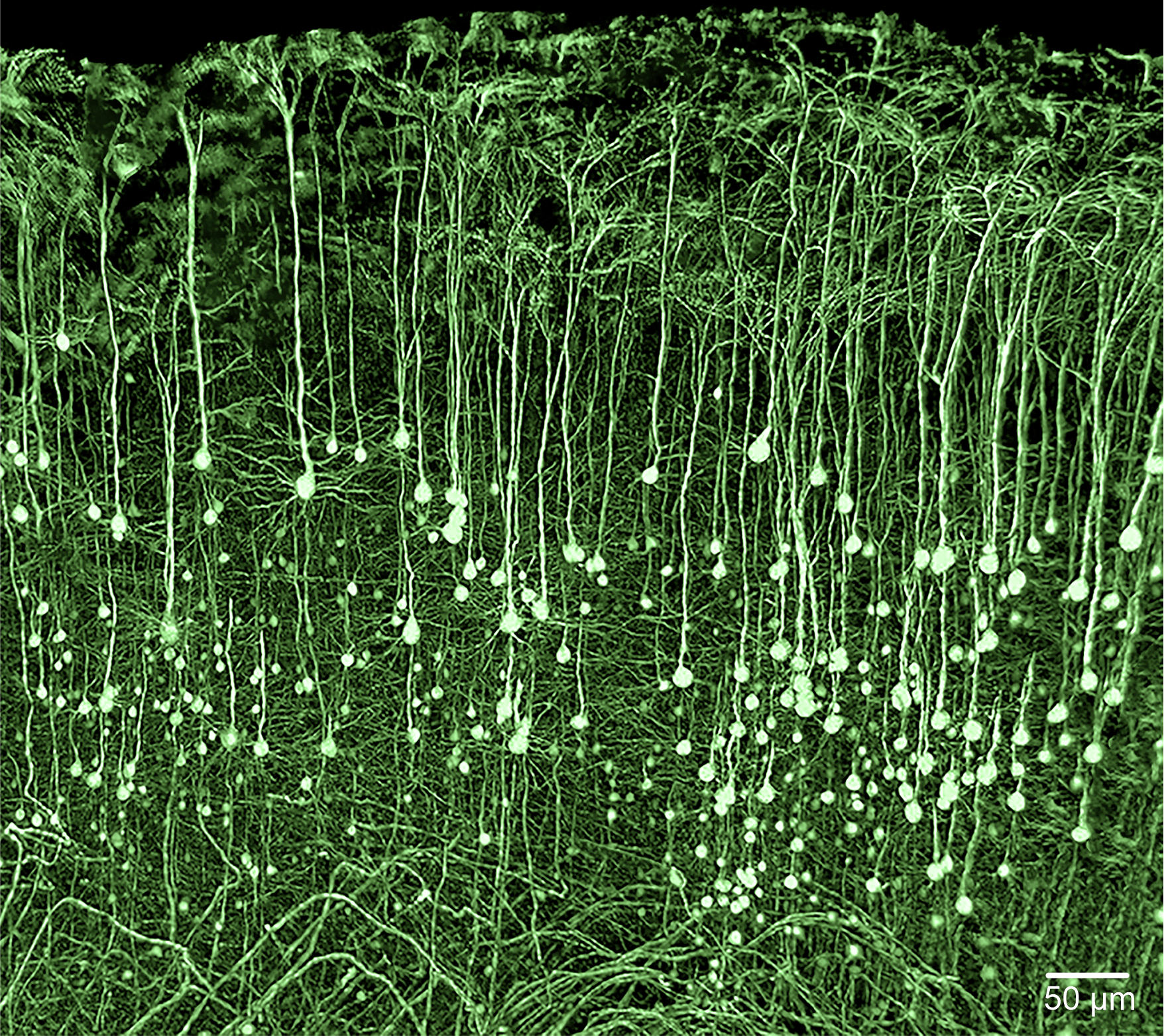 Hippocampal neurons